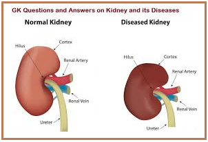 Kidney and its diseases